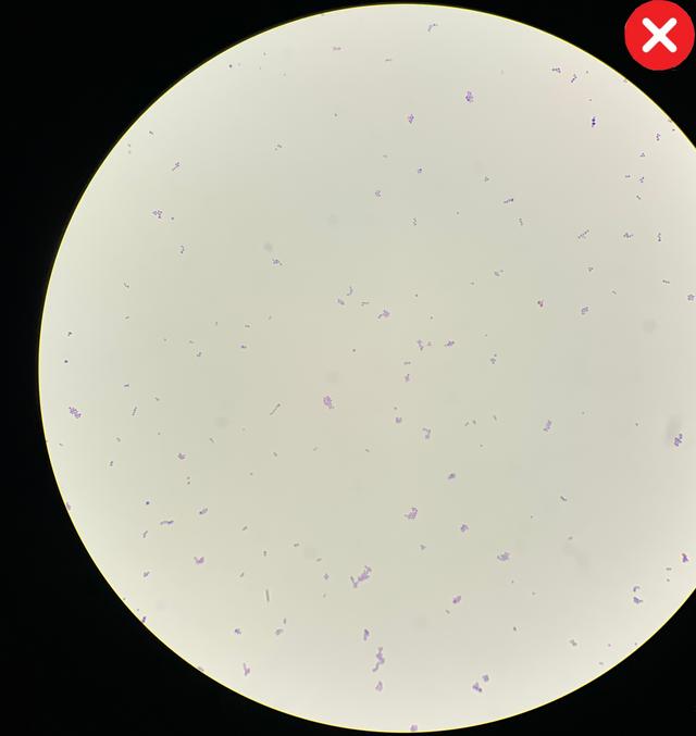 Bad Gram Stained Sample