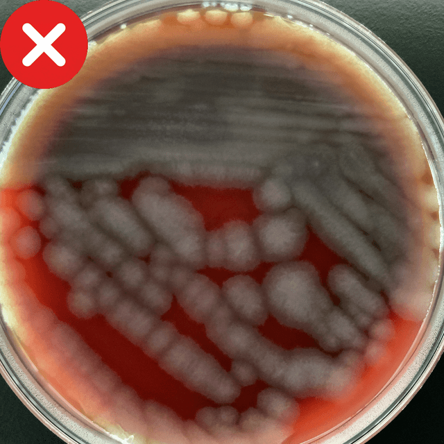 Incorrect example without isolated colonies
