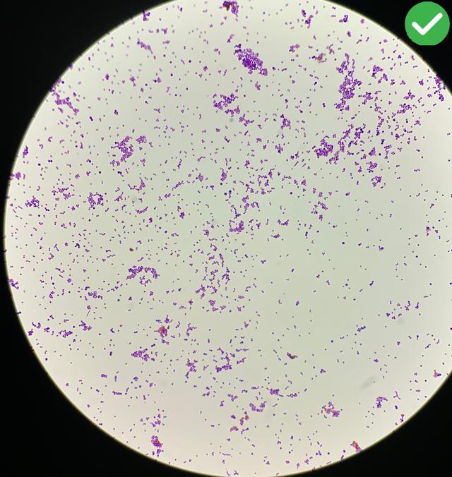 Correctly Gram Stained Sample