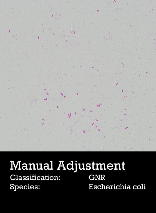 Manual Adjustment in BiTTE Lite Analysis