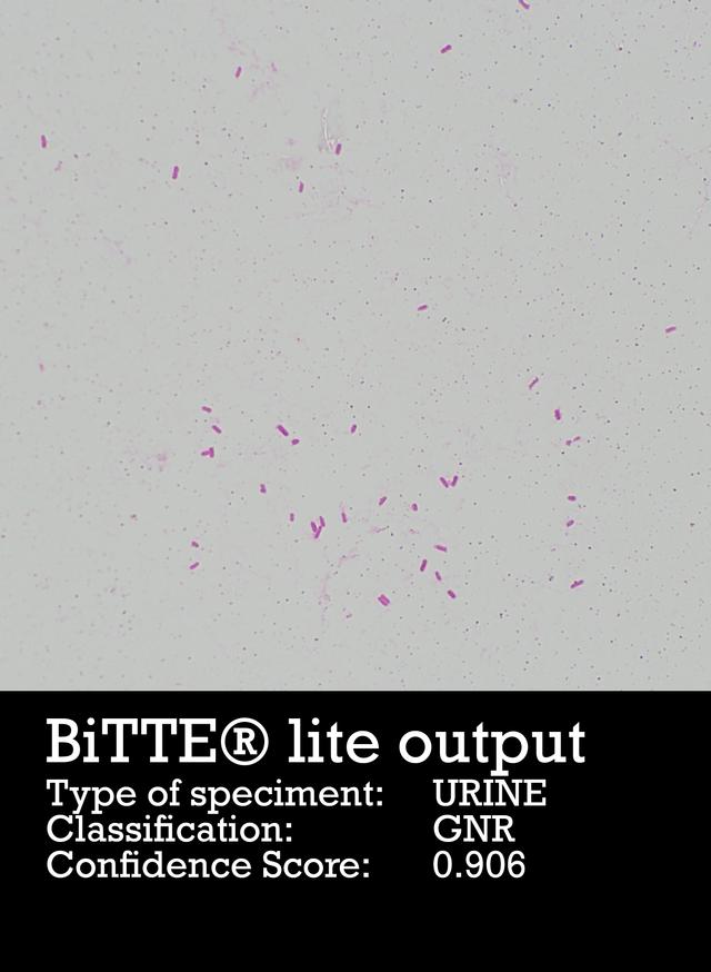 Output Image from BiTTE Lite Analysis