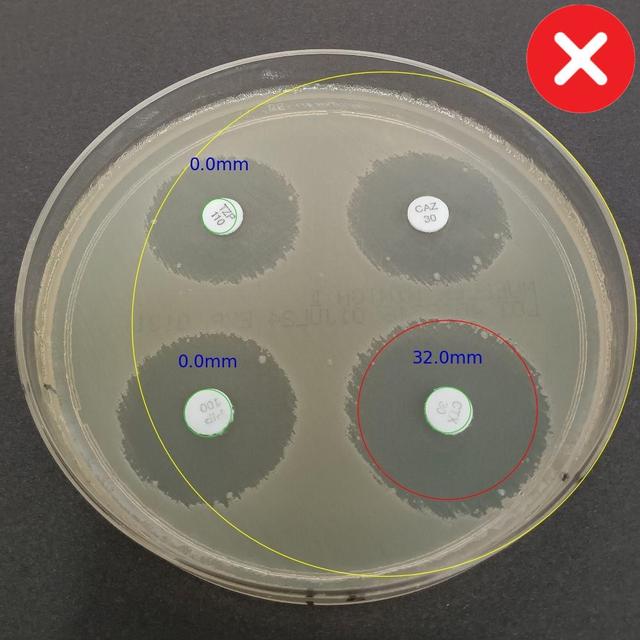 Incorrect Petri Dish Photo Example