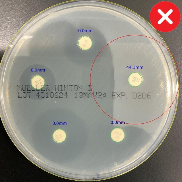 Misaligned Plate Photo Example