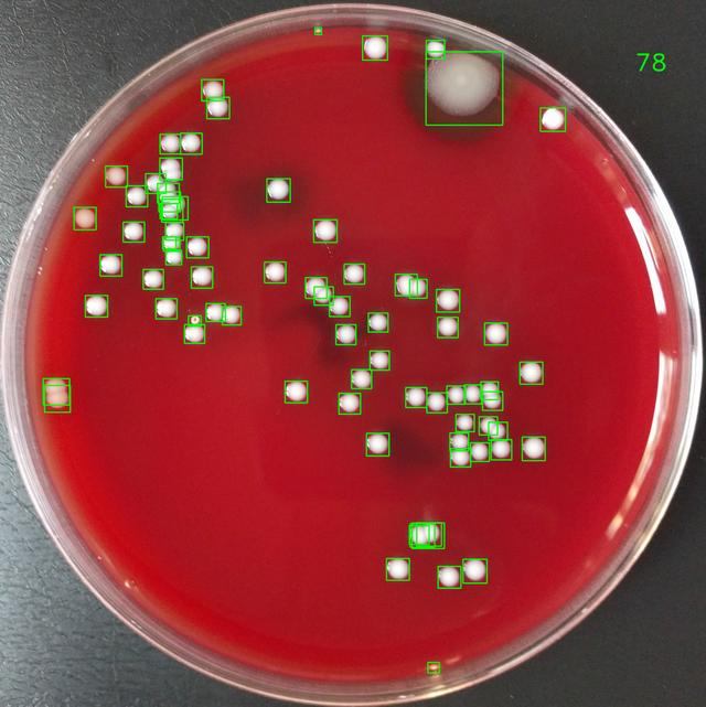 Sample Output for Colony Counter