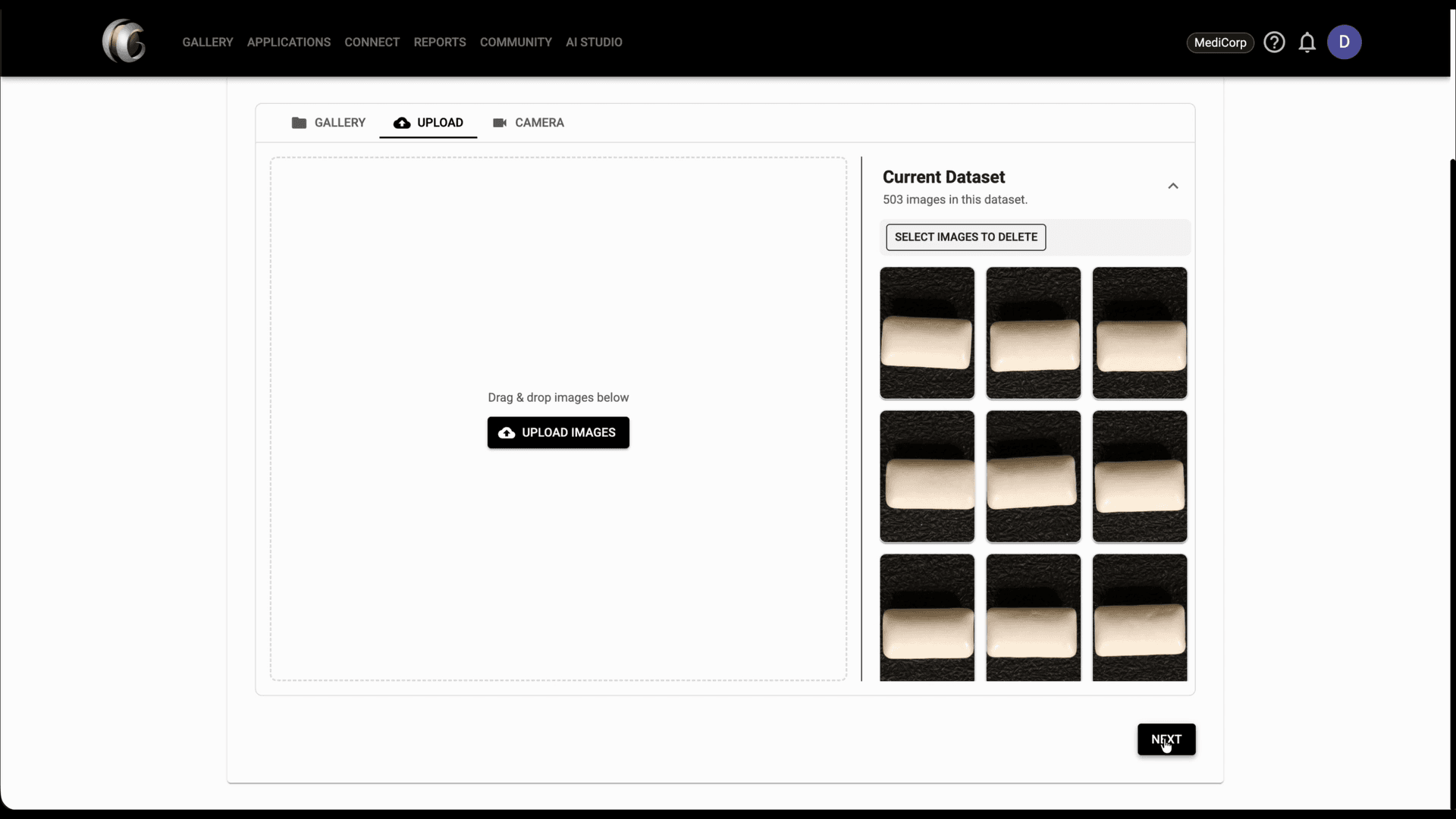 Upload step screenshot