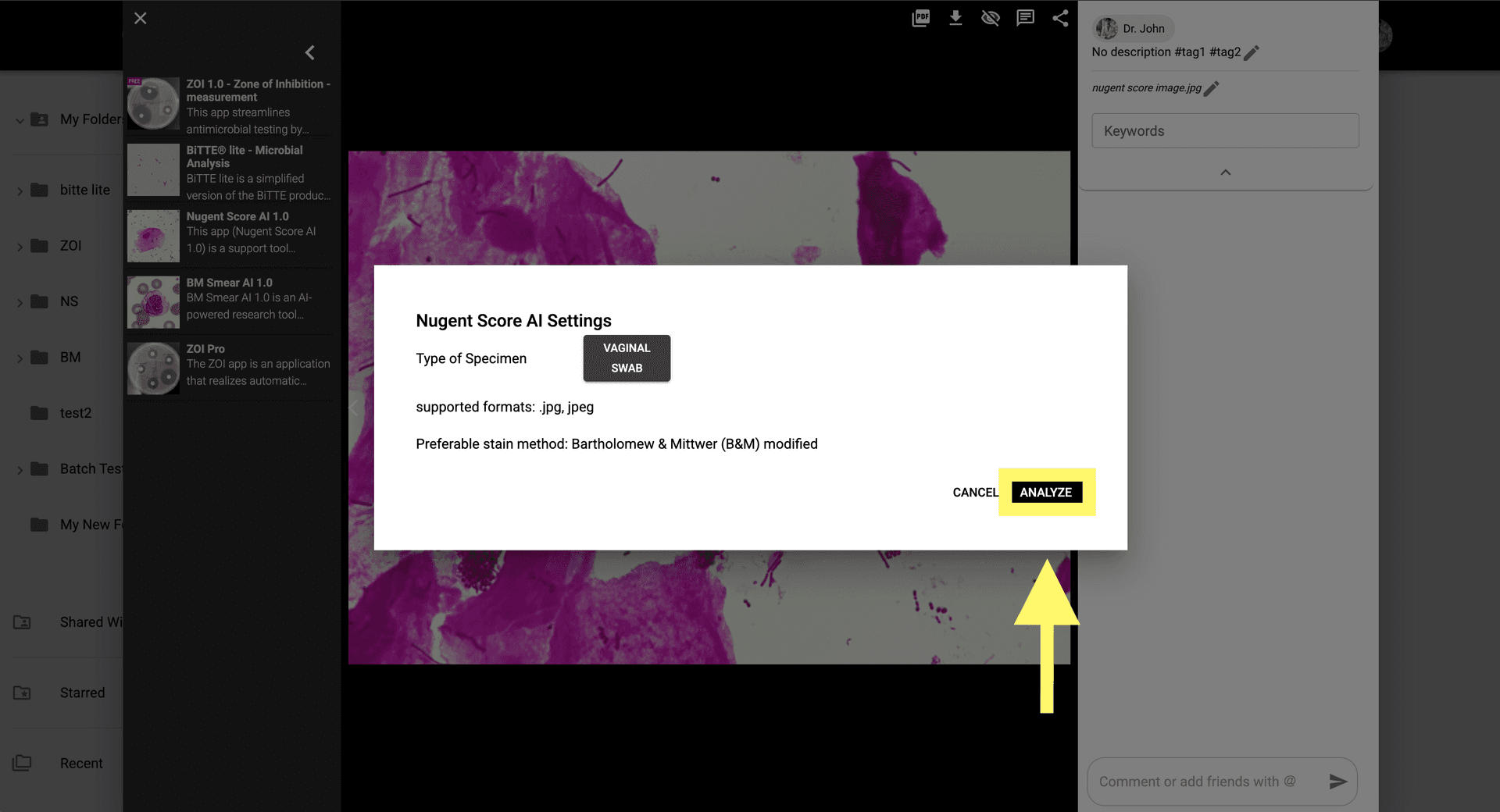 Step 4: Cliquez sur 'Analyser' pour lancer le scoring basé sur l'IA sur l'image de microscopie.