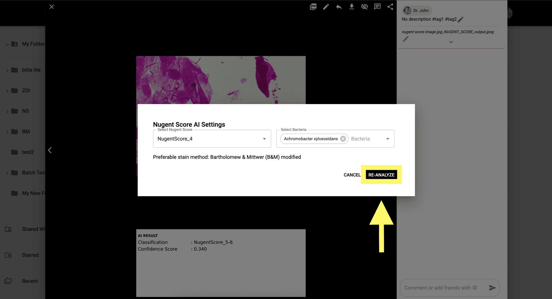 Step 8: Cliquez sur 'Ré-analyser' pour enregistrer les modifications manuelles et mettre à jour le score final.