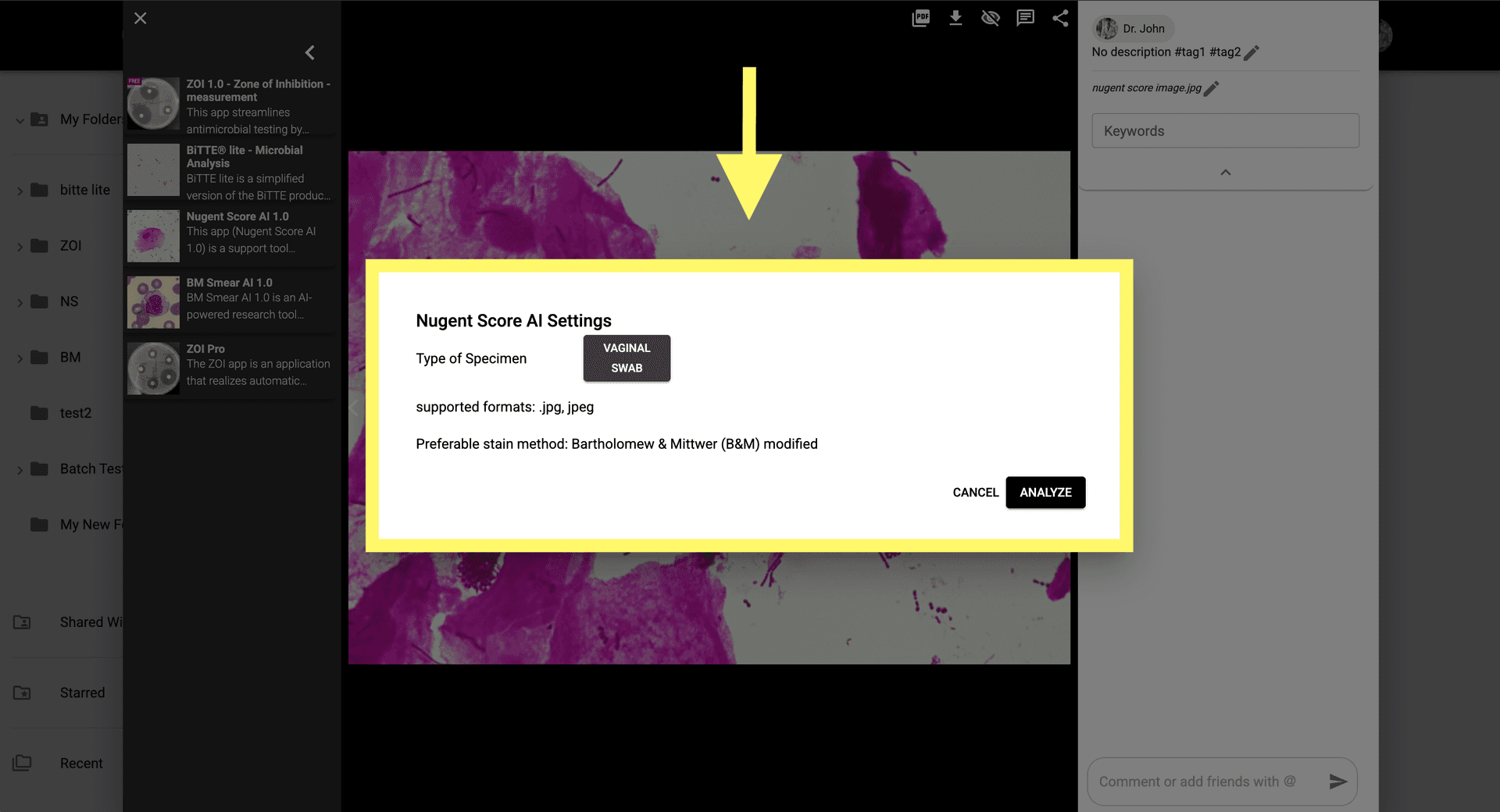Step 3: Configurez les paramètres pour classifier les populations bactériennes selon le système de score de Nugent.