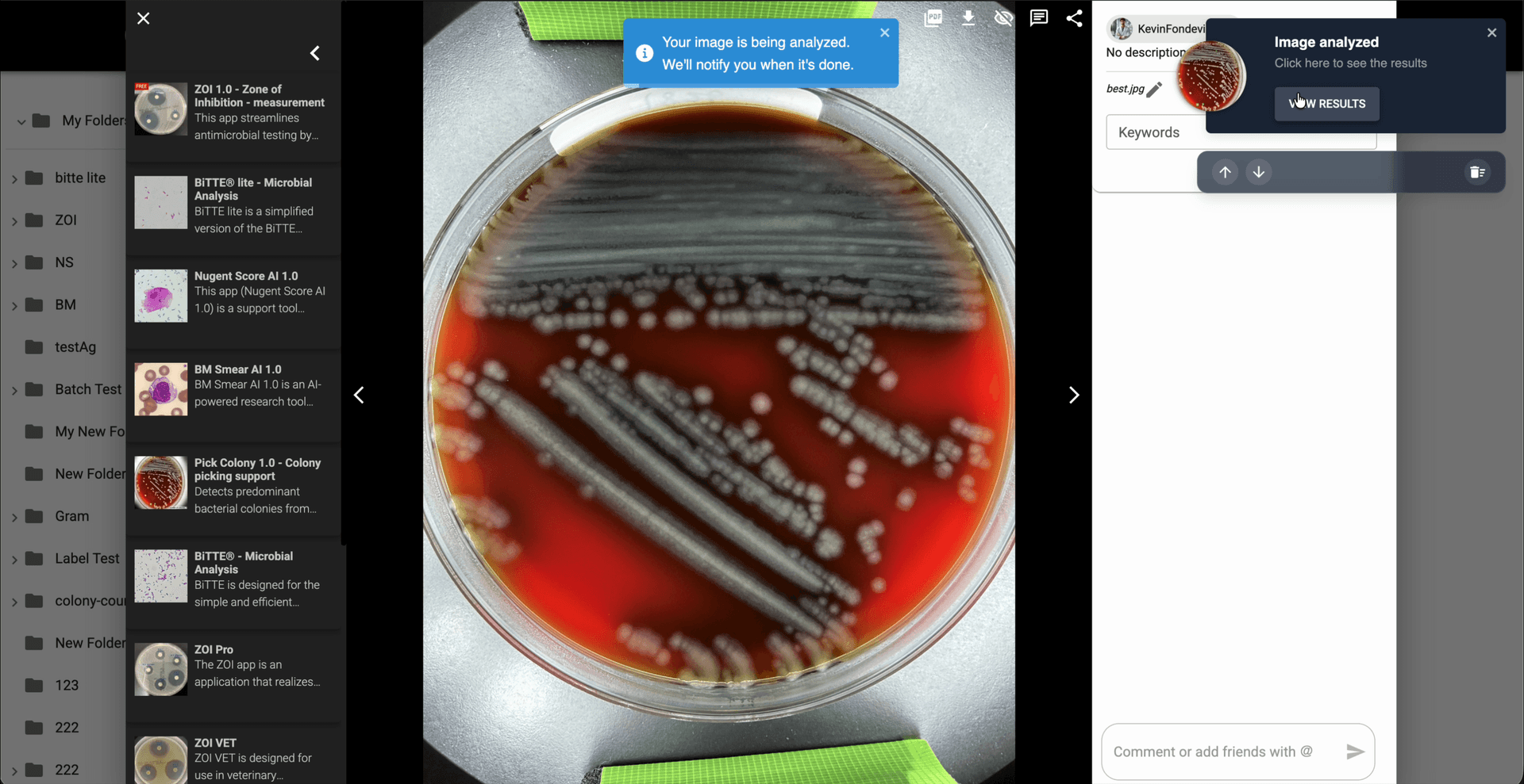 Step 4: Espera a que termine el análisis y luego usa 'View Results' en la notificación para abrir la imagen de resultado generada.