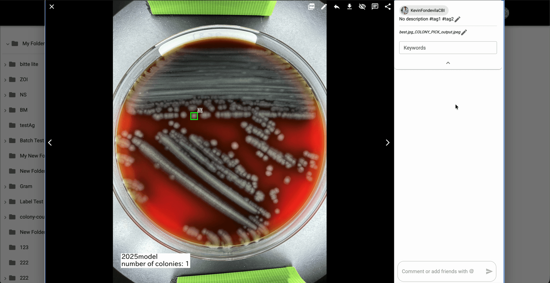 Step 5: Revisa la imagen generada `_COLONY_PICK_output` y confirma la colonia resaltada junto con el resumen `number of colonies` que aparece en el resultado.