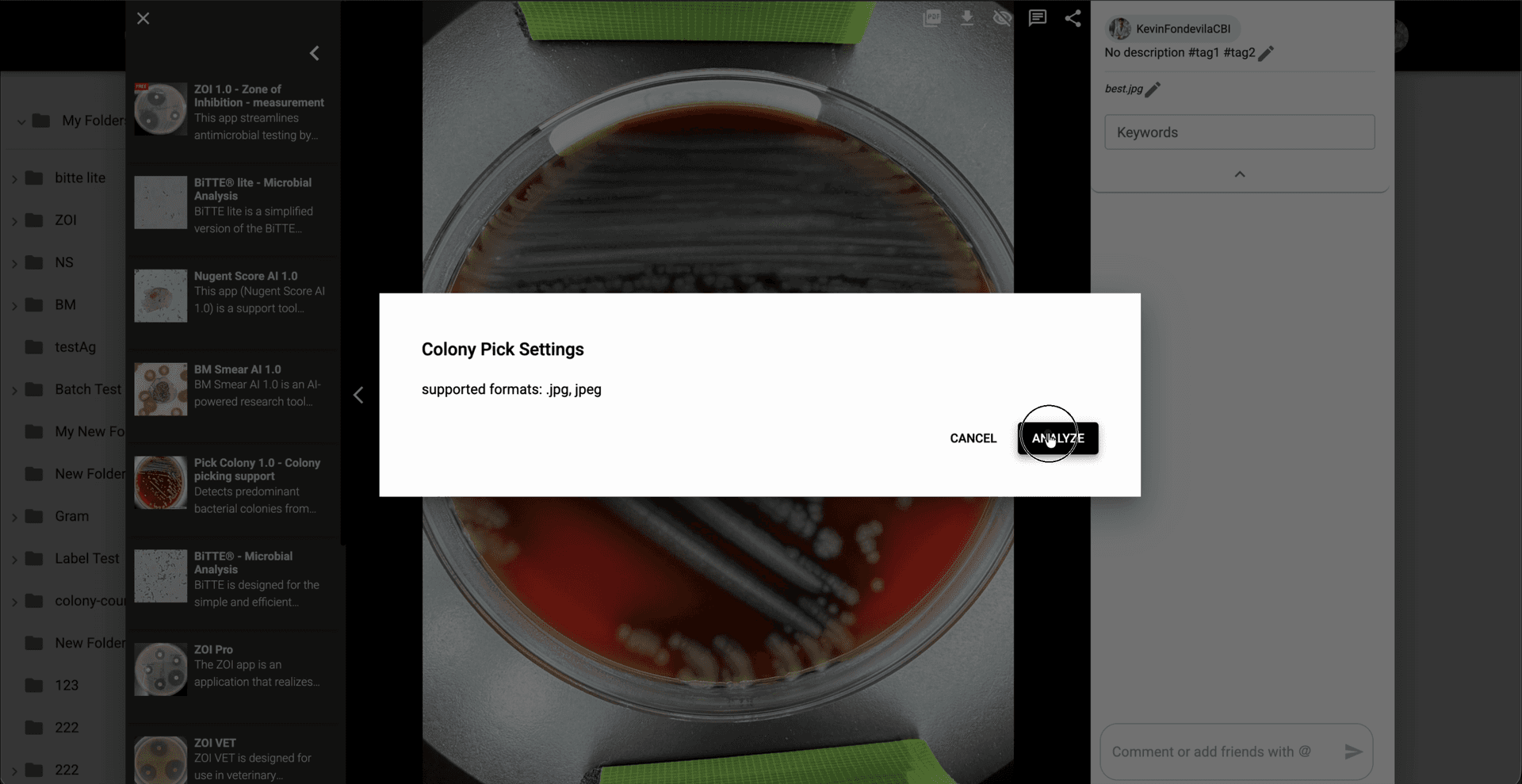 Step 3: En Colony Pick Settings, revisa el formato soportado y haz clic en 'Analyze' para iniciar el análisis de selección de colonias por defecto.